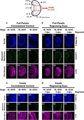 Using the Xenopus Developmental Eye Regrowth System to Distinguish the Role of Developmental Versus Regenerative Mechanisms